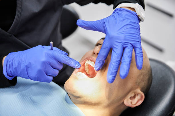 Best Emergency Dental Care for Broken or Chipped Teeth in Crawfordville, FL
